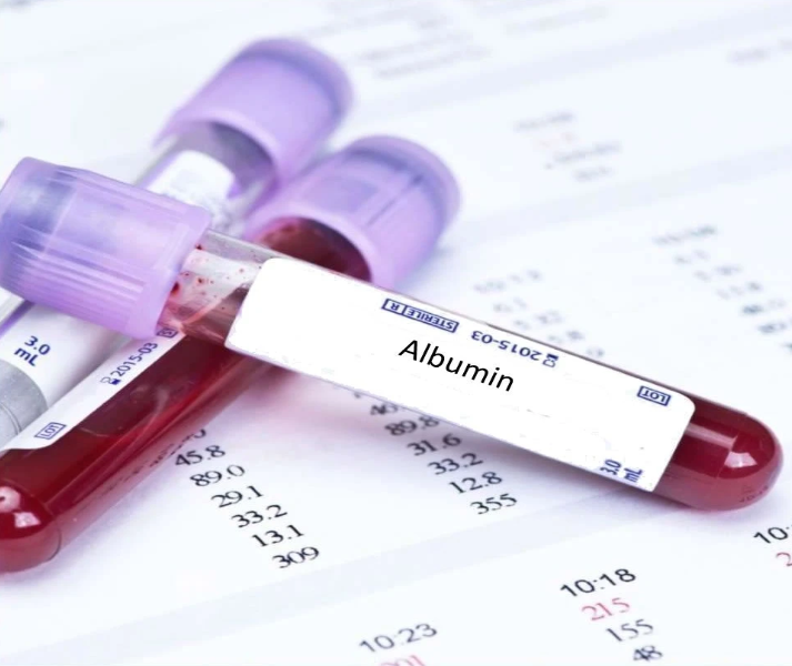 Albumino kraujo tyrimas